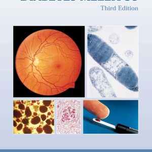 Atlas of Diabetes Mellitus 3rd Edition by Ian N. Scobie