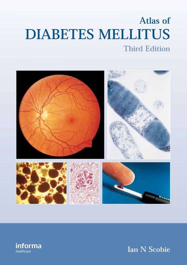 Atlas of Diabetes Mellitus 3rd Edition by Ian N. Scobie