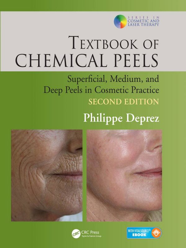 Textbook of Chemical Peels Superficial Medium and Deep Peels in Cosmetic Practice 2nd Edition