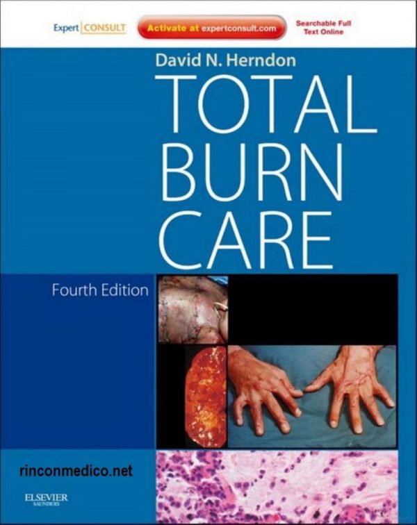 Total Burn Care 4th Edition