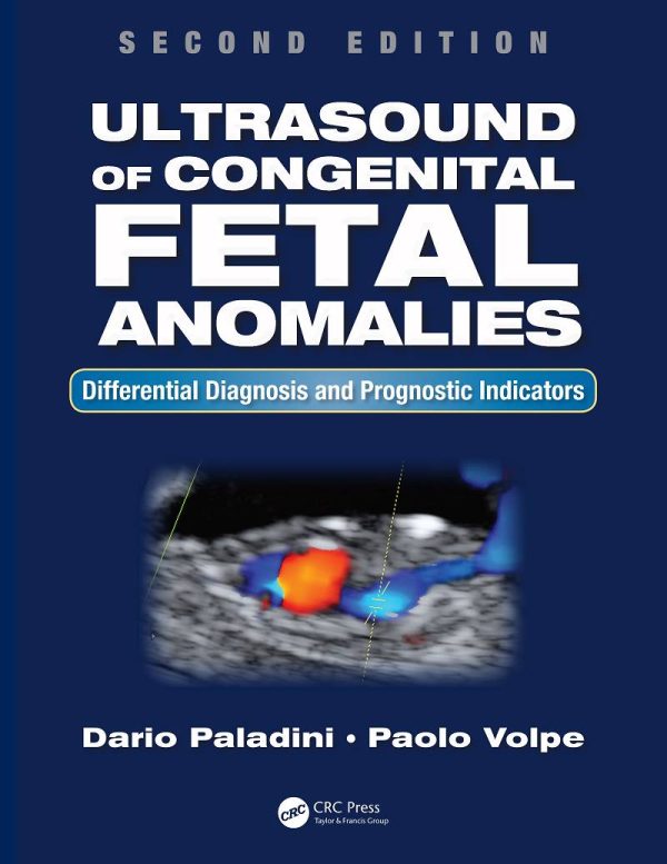 Ultrasound of Congenital Fetal Anomalies 2nd Edition