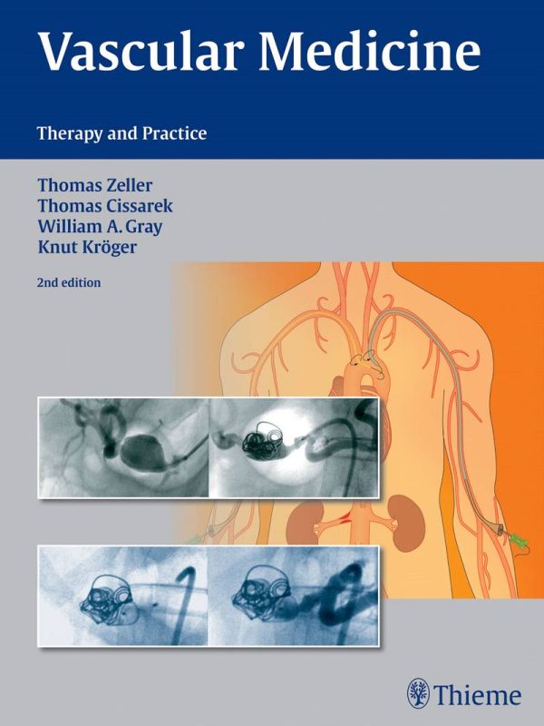 Vascular Medicine Therapy and Practice 2nd Edition